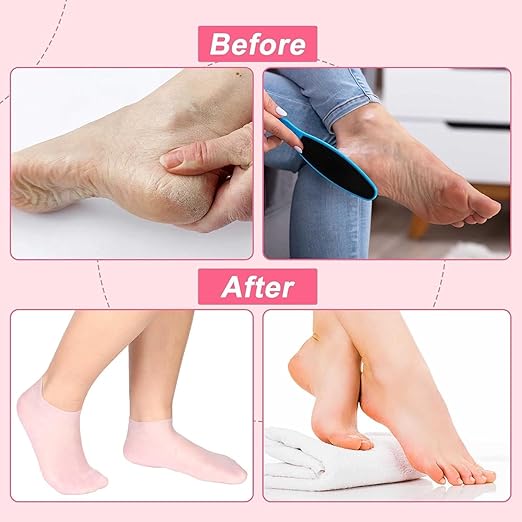 Foot Hydration Socks image 3