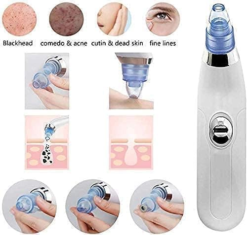 Derma Suction Electric Facial Pore Cleanser – Vacuum Blackhead Remover & Acne Suction Tool with 4 Interchangeable Heads image 4